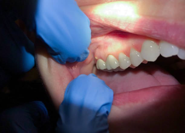 Best Emergency Tooth Extraction  in Henderson, GA