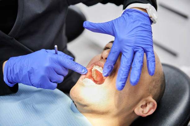 Best Knocked-Out Tooth Emergency  in Henderson, GA